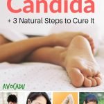 10 Signs You Have Candida + 3 Steps to Naturally Cure It | quickcreativityclubusa.com