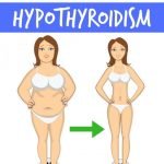 How to lose weight with Hyperthyroidism | Diet Plans for women to lose weight with thyroid problems | quickcreativityclubusa.com