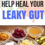 10 Foods that help heal your leaky gut | Gut health is connected to weight loss, mental health, and so much more | quickcreativityclubusa.com